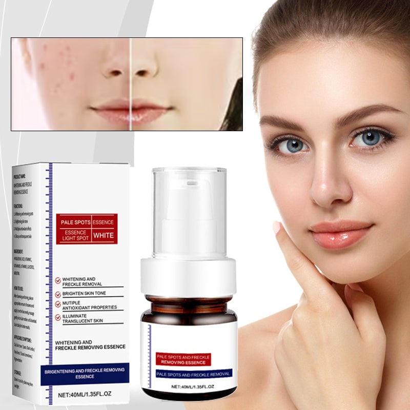 Crema facial blanqueadora de pecas con vitamina C