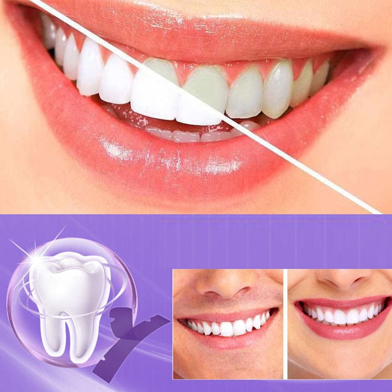 Teeth whitening strips