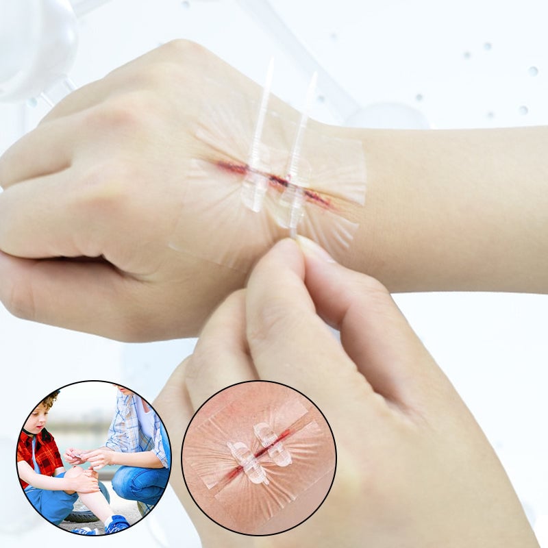 Portable Wound Protection Injury Healing for Outdoor Use Easy (2-strapsx2 pcs/box)