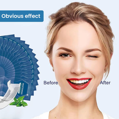 Teeth Whitening Strips