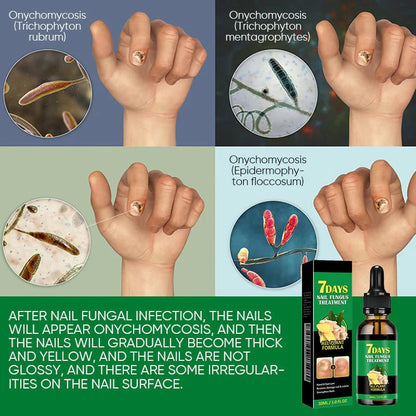 Tratamiento de uñas de jengibre