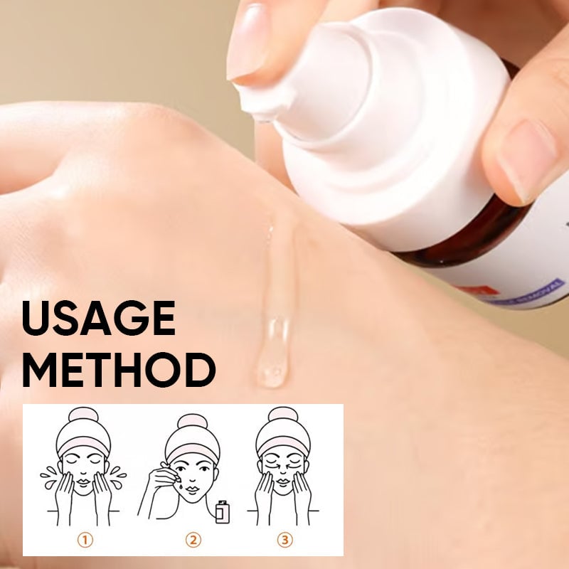 Crema facial blanqueadora de pecas con vitamina C