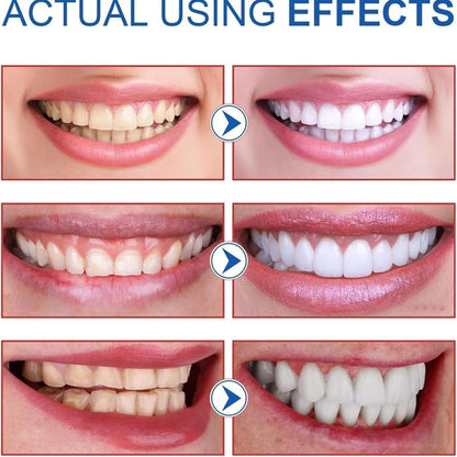 SP-8/SP-10 Probiotic Whitening Toothpaste for Oral Health