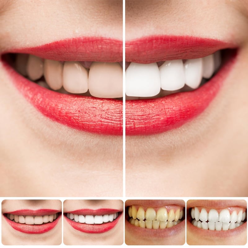 SP-8/SP-10 Probiotic Whitening Toothpaste for Oral Health