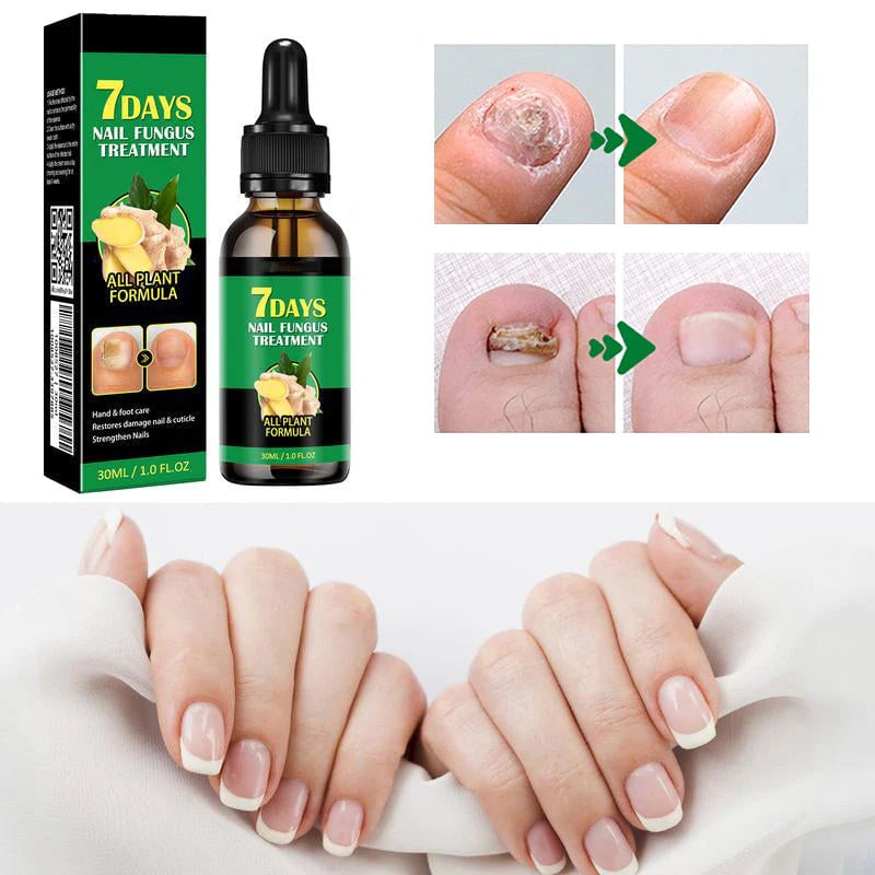 Tratamiento de uñas de jengibre