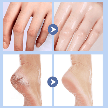 🔥❤️Foot Care Cream