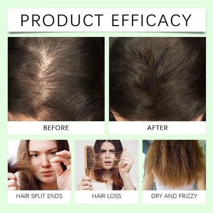 🧴🪮Anti-Hair Fall Hair Loss Shampoo
