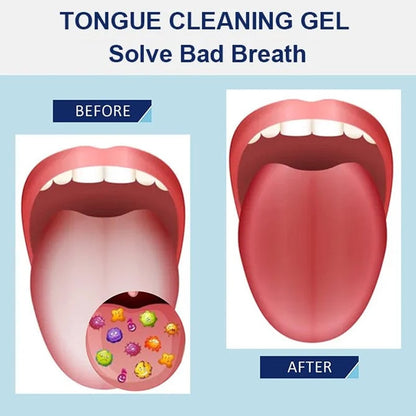✨Tongue Cleaning Gel Set👅