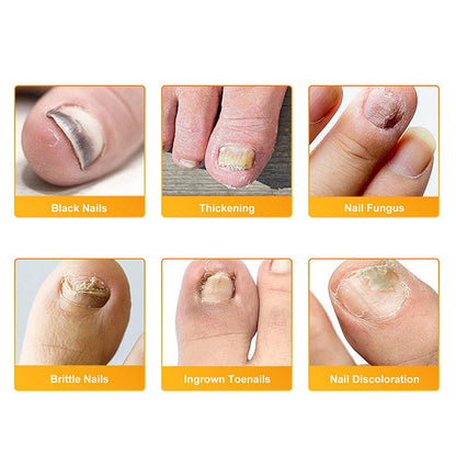 Fungal Nail Patches
