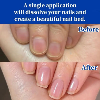 Antifungal Nail Repair Solution