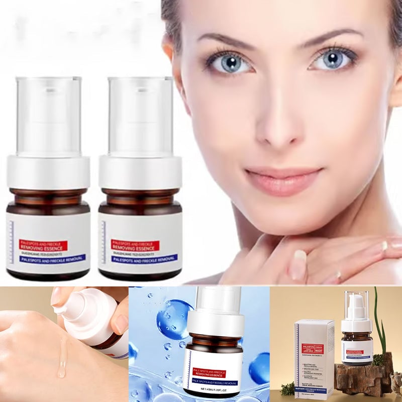 Crema facial blanqueadora de pecas con vitamina C