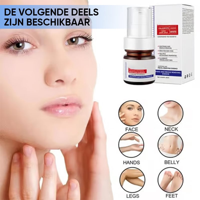Crema facial blanqueadora de pecas con vitamina C