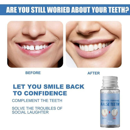👨‍⚕️Moldable False Teeth for Temporary Tooth Fillings