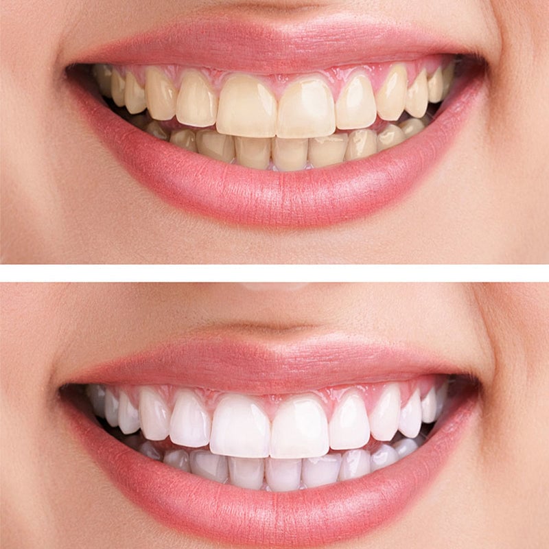 Pasta de dientes con hidroxiapatita