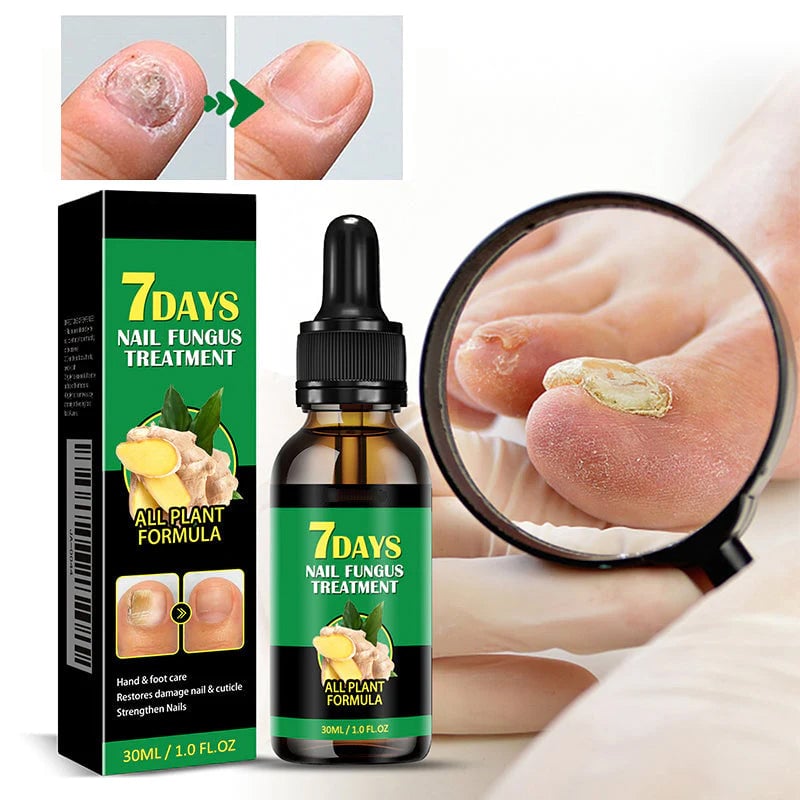 Tratamiento de uñas de jengibre