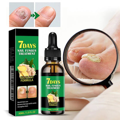 Tratamiento de uñas de jengibre