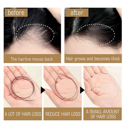 🧴🪮Anti-Hair Fall Hair Loss Shampoo