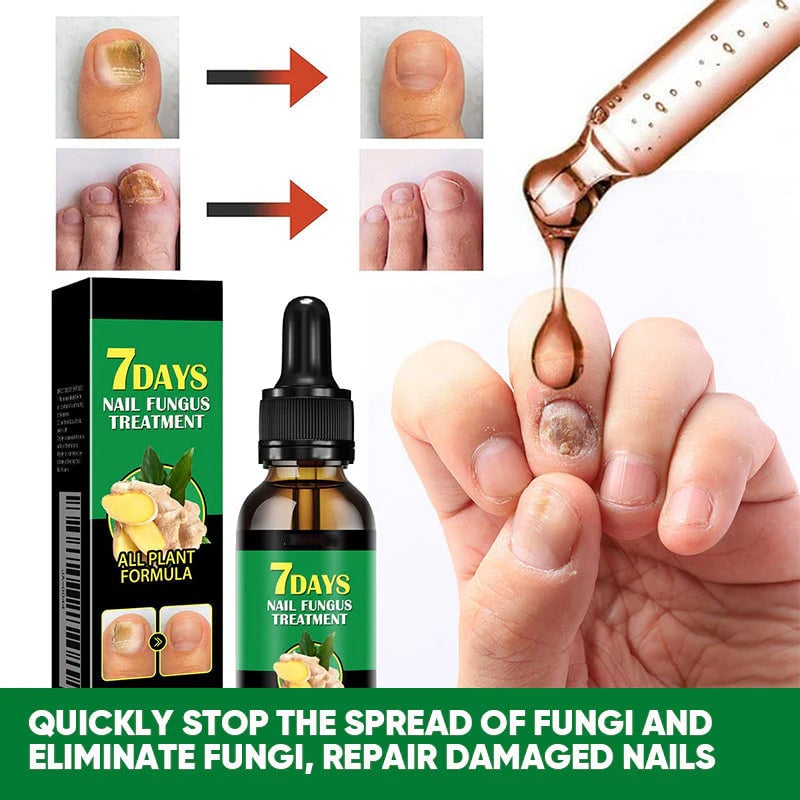 Tratamiento de uñas de jengibre
